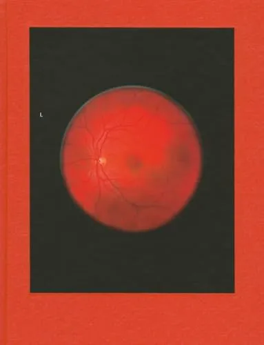 Couverture de Retinal Shift