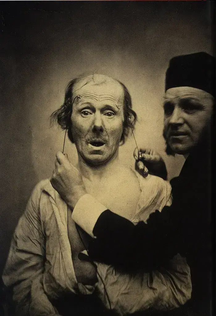 Grimaces savantes : autour de Duchenne de Boulogne, École Municipale d'Art, Boulogne-sur-Mer